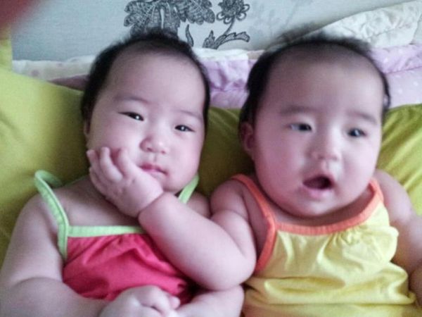 Kembar Jung Dasor & Jung Dain, 7 Bulan, Perempuan