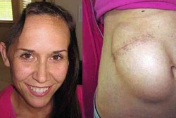 Sebagian Tengkorak Mantan Ratu Kecantikan ini Disimpan di Perut Sendiri