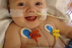 Disarankan Meninggal Alami, Bayi Cacat Jantung Hidup Selamat