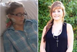 Pasang Tindik Biar Gaya, Gadis Ini Malah Kena Infeksi Jantung Mematikan