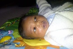 6 Tumor Menempel di Mata Jernih Bayi Romero