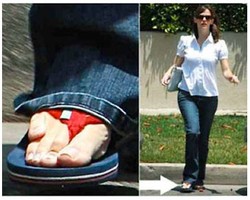 Ketidaksempurnaan Tubuh 10 Artis Dunia