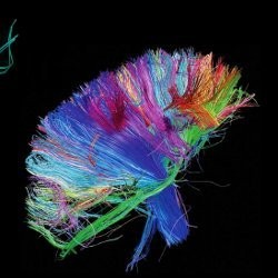 Album The 2nd Law: Evolusi Total Muse