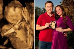 Piss! Bayi Ini Sudah Narsis Sejak Dalam Kandungan