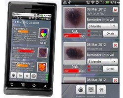 Tahi Lalat Berpotensi Kanker? Cari Tahu dengan Aplikasi Doctor Mole