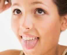 Empat Hal Perlu Diketahui Tentang Kesehatan Lidah