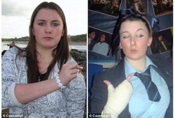 Remaja Putri yang Tiap Hari Harus Minum 36 Jenis Obat untuk Redakan Migrain