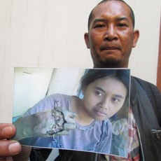 Terbakar di Hawu, Yani Kehilangan Tangan Kanannya