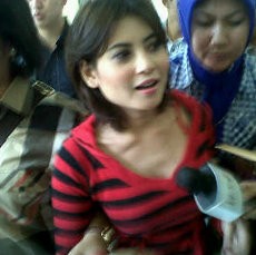 Novi Amilia Mengalami Masalah di Bagian Kepala