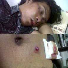 Bentrok dengan Polisi di Pamulang, Kepala Jundy Retak & Muntah Darah