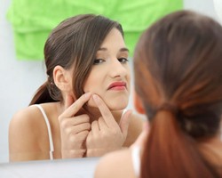 Wah! Ternyata 3 Benda Ini Dapat Timbulkan Jerawat 