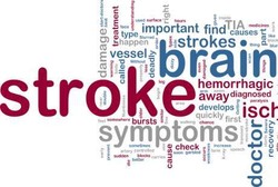 Ingin Jauh-jauh dari Stroke? Lakukan Ini