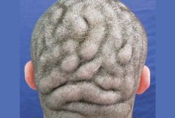 Ini Kulit Kepala Lho Bukan Otak!