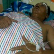 Oknum TNI Hajar Warga Sipil Hingga Tujuh Giginya Rontok