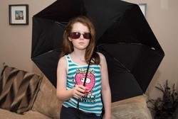 Alergi Cahaya, Nonton TV Saja Bikin Kulit Bocah Ini Merah-merah