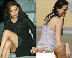 Penampakan Selulit di Tubuh 10 Selebriti Seksi