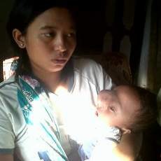 Aturan Baru Jadi Penyebab Balita Penderita Hydrocephalus Ditolak RSU dr Soetomo