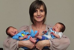 Bayi Kembar Berbagi Plasenta Ini Berhasil Selamat Berkat Bedah Laser