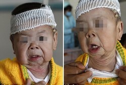 Bayi Umur 1 Tahun, Kulitnya Sudah Seperti Nenek-nenek