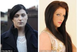 Kemaluan yang Bikin Galau, Remaja Ini Dua Kali Ganti Kelamin