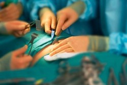 Kesalahan Operasi Terbanyak: Alat Ketinggalan dan Salah Organ