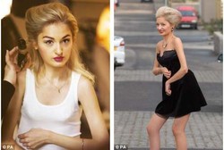 Penyakit Tubuh Kaku Bak Manekin Tak Halangi Gadis Ini Kejar Mimpi