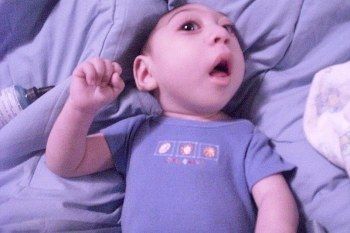 Ajaib! Bertahan Hidup 3 Tahun Meski Terlahir Tanpa Otak