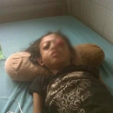 Kasihan, ABG Asal Cipatat Ini Bola Matanya Keluar