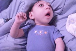 Meski Akhirnya Meninggal, Bocah Ini Bertahan Hidup 3 Tahun Tanpa Otak