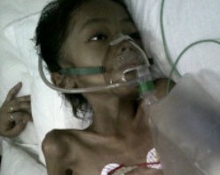 Ayah Bocah dengan Kanker Ganas Ganti Nama Anaknya Berharap Sembuh