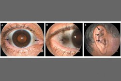 Pria Ini Kena Sindrom Langka, Sendi dan Tulang Mudanya Menghitam