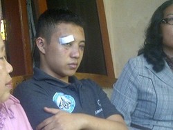 Akibat Dibogem Diego Michiels, Mef Cacat Sementara