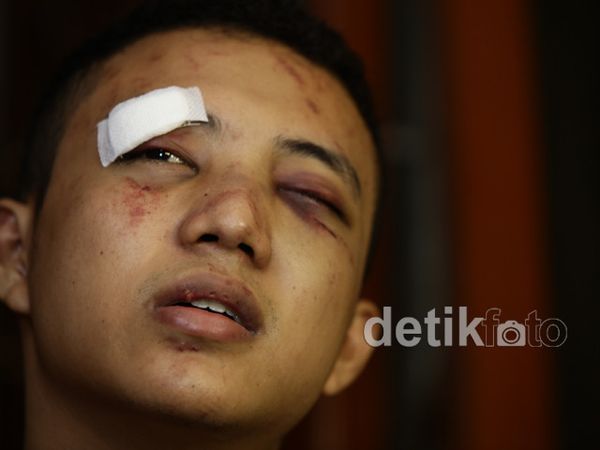 Dibogem Diego Michiels, Mef Cacat Sementara