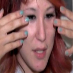 Duh! Gara-gara Mencari Sinyal, Remaja Ini Malah Digigit Ular