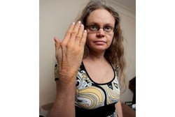 Wanita Kadal, Kulitnya Bersisik dari Kepala Hingga Kaki