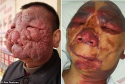 Muka Jadi Berantakan karena Tumor Besar Tumbuh di Wajah