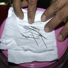 Diobati Paranormal, 20 Jarum Keluar dari Kepala Pemuda Asal Blitar