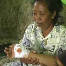 Wanita Penjual Mainan Jadi Korban Peluru Nyasar