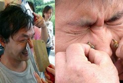 Iiih! 5 Pengobatan Ini Bikin Merinding