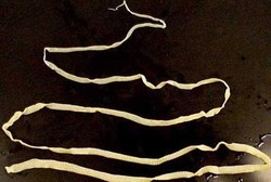 Infeksi Cacing Pita, Gangguan Akibat Penyebaran Telur dan Larva Cacing Pita dalam Tubuh