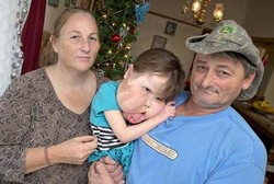 Pipi Bocah Ini Bengkak Tak Normal Sejak Lahir Karena Penyakit Langka