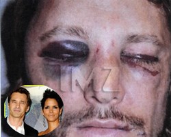 Dipukul Olivier Martinez, Wajah Mantan Kekasih Halle Berry Bonyok