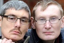 Penyakit Langka Sulap 2 Bersaudara Ini Kembali Jadi Anak-anak