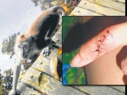 Nahas! Diserang Monyet & Dapat 13 Jahitan Saat Liburan