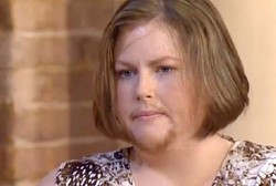 Kisah Siobhain Fletcher, Perempuan Tulen yang Punya Jenggot & Kumis