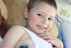 Bocah Leukemia yang Menanti Donor Sumsum Setelah Rumahnya Hancur