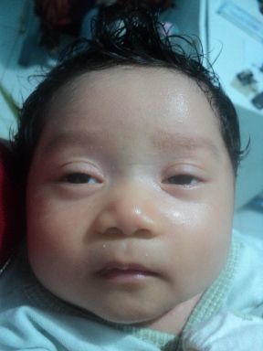 Alauna Zata Yumni Ocnomei, 5 Bulan, Perempuan