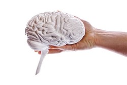 Arteriovenous Malformation Otak, Koneksi Abnormal Pembuluh Darah di Otak