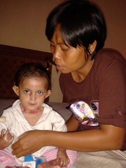 Kemenpora Telah Bantu Rp 10 Juta untuk Pengobatan Anak Leni