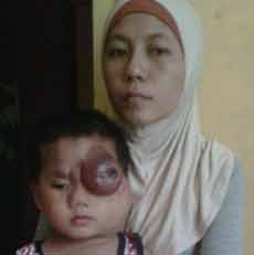 Berawal dari Jatuh, Arif Alami Tumor Ganas